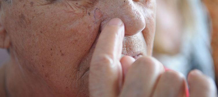 Ministério da Saúde abre consulta sobre diagnóstico do câncer de pele