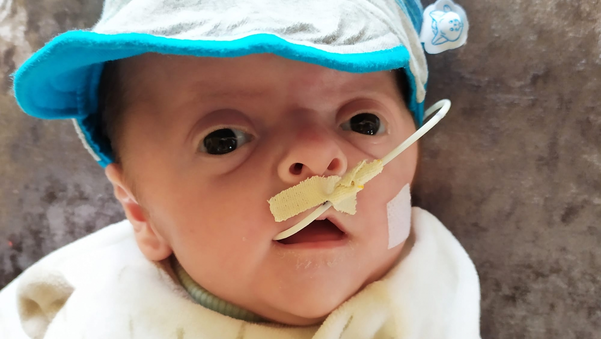 Vídeo: Bebê com síndrome rara conta com doações para cirurgia urgente em Schroeder