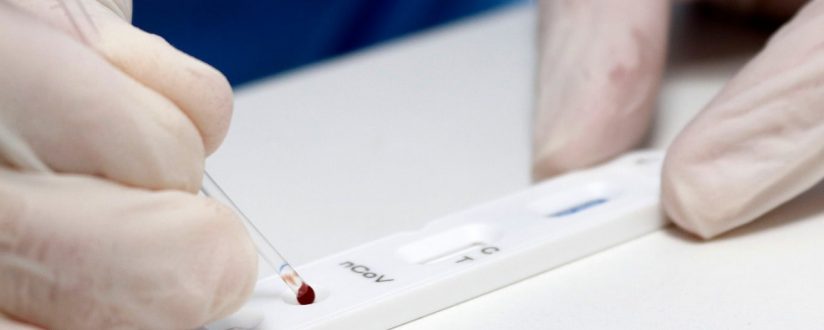 Guaramirim fará teste rápido em pessoas assintomáticas neste sábado Guaramirim fará teste rápido em pessoas assintomáticas neste sábado