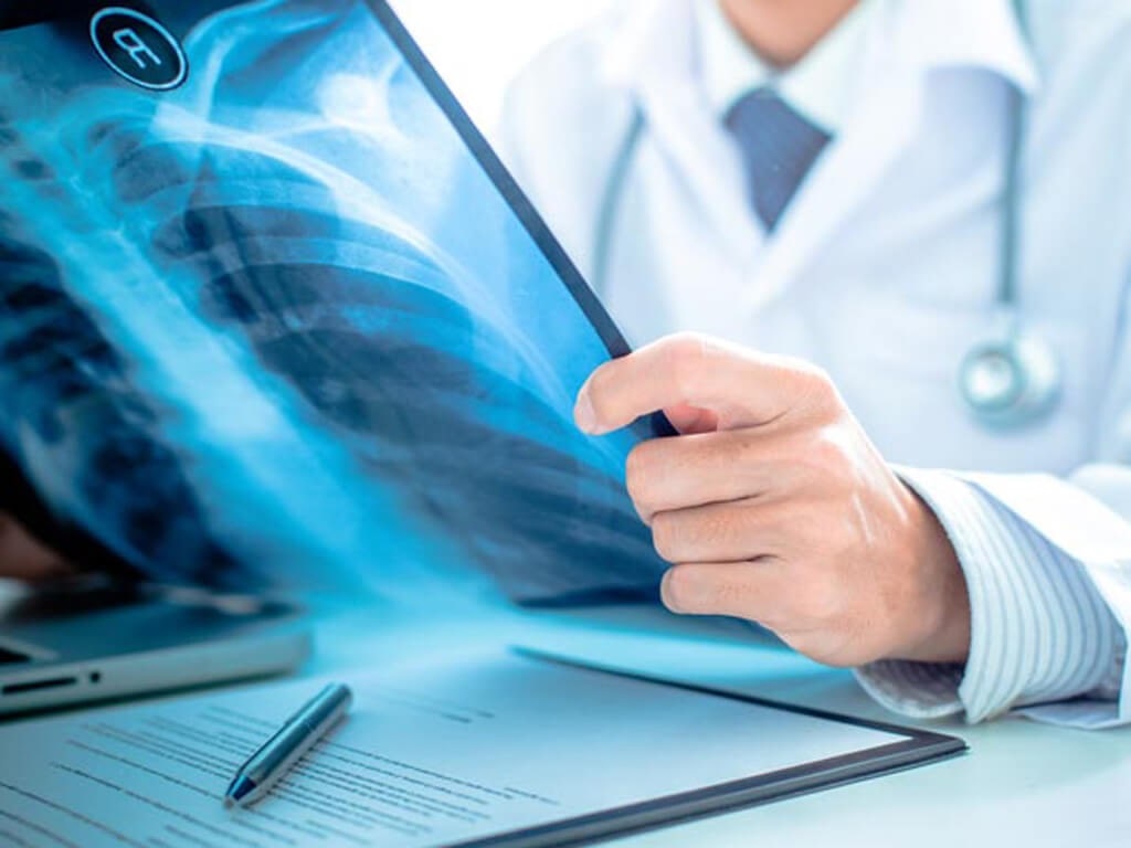 Exames de raios x do pronto atendimento de Corupá serão temporariamente feitos no hospital São José