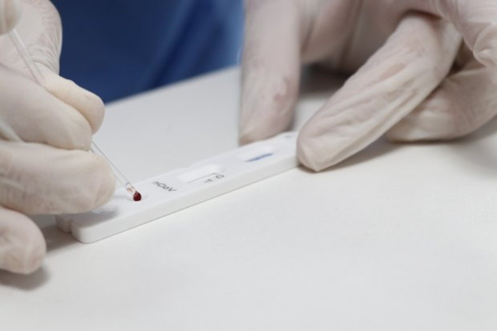 Dive divulga novas orientações para isolamento em SC