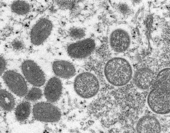 Dive monitora caso suspeito da varíola dos macacos em Santa Catarina