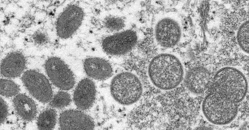 Dive monitora caso suspeito da varíola dos macacos em Santa Catarina