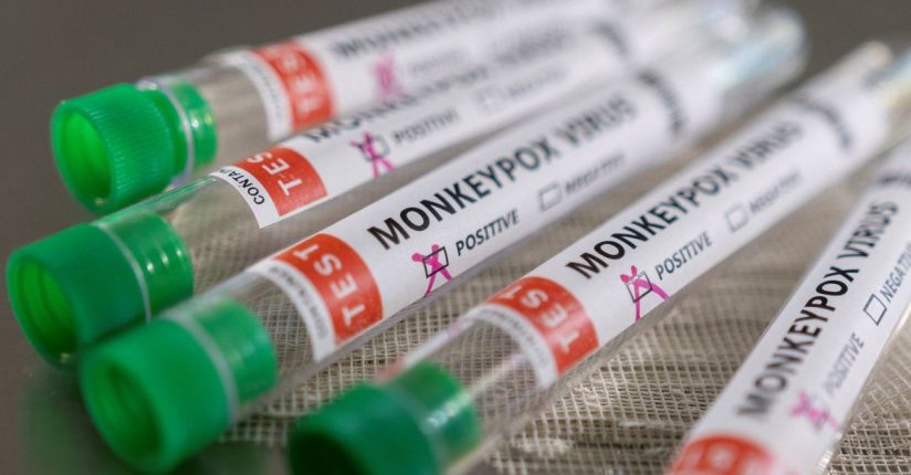 Anvisa orienta hospitais sobre casos de varíola dos macacos