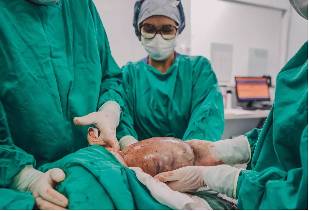 [VÍDEO] – Bebê nasce empelicado em SC