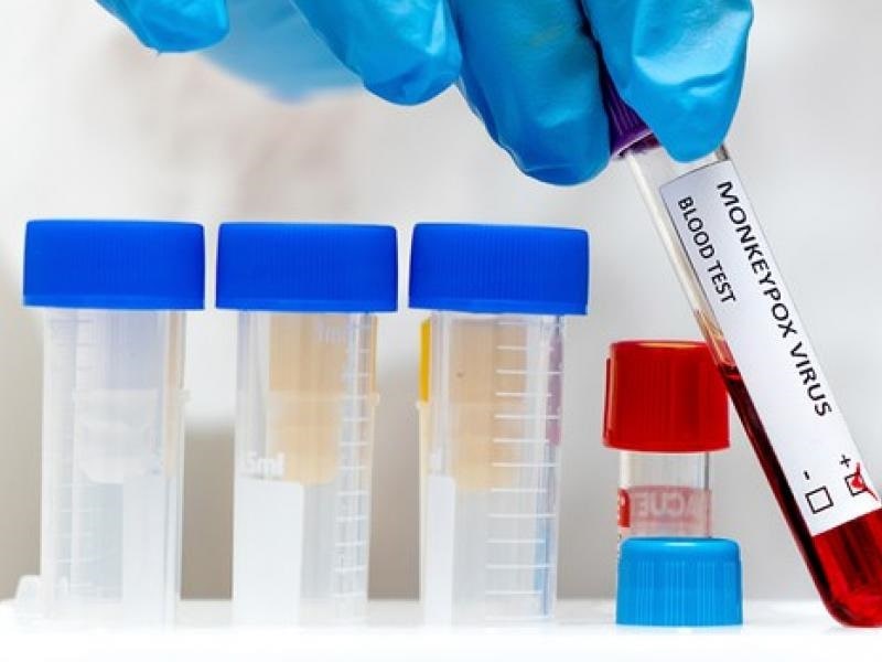 ANS determina que planos cubram teste para varíola dos macacos