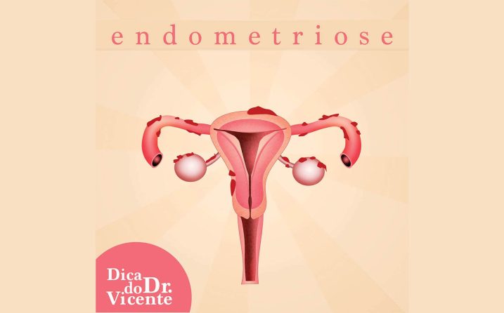 Coluna: endometriose