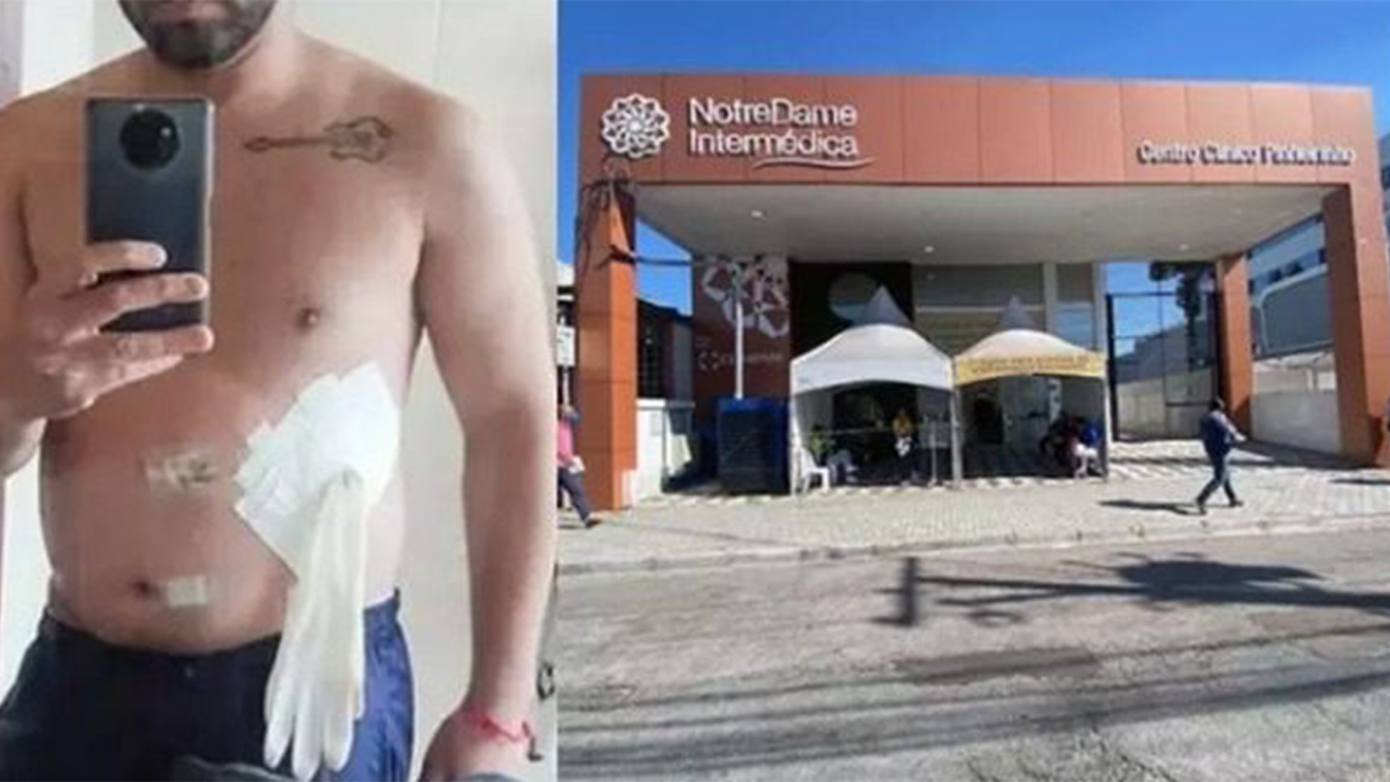 Médico coloca luva no lugar de bolsa de colostomia em paciente