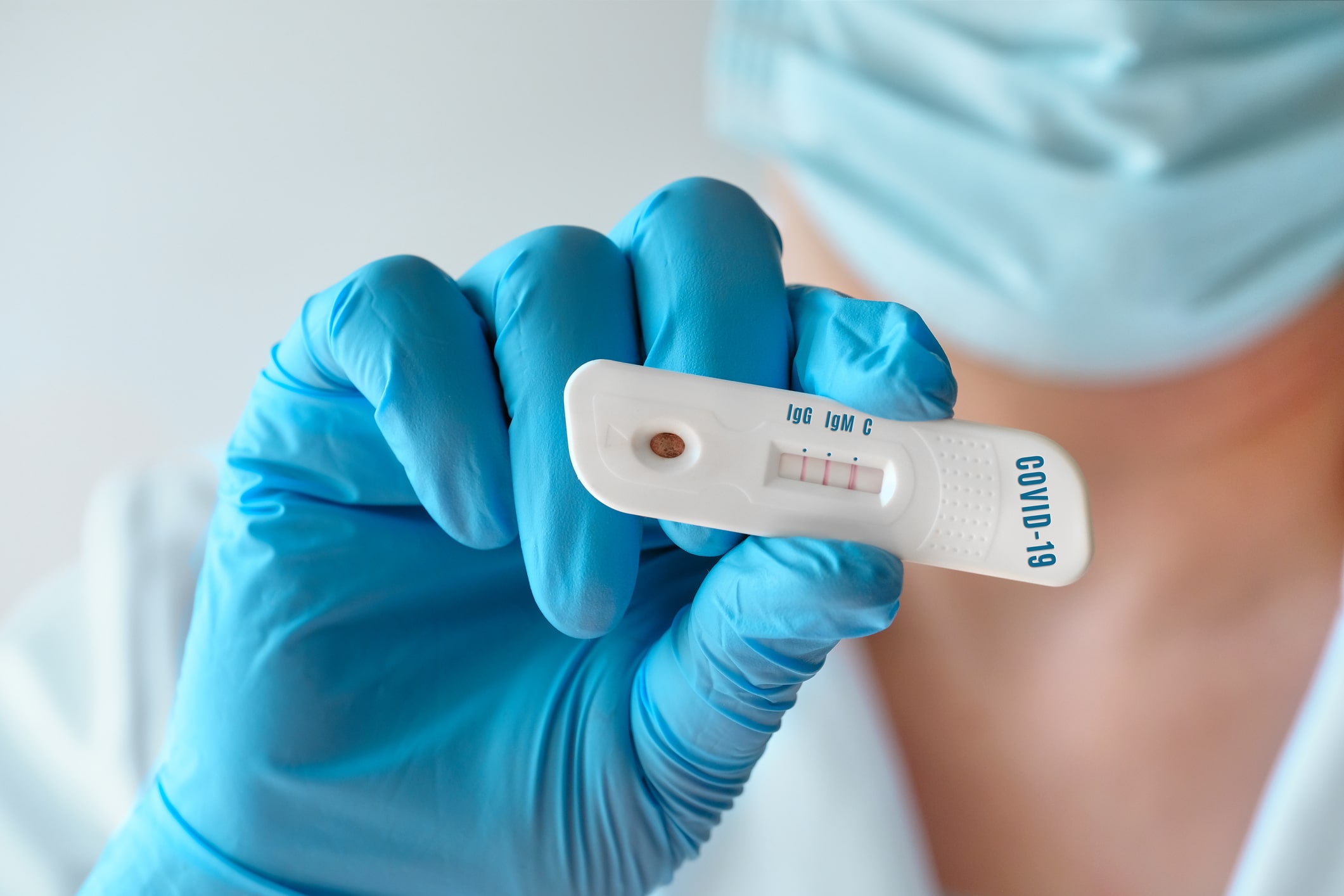 Todas as unidades de saúde realizam testes rápidos de Covid-19