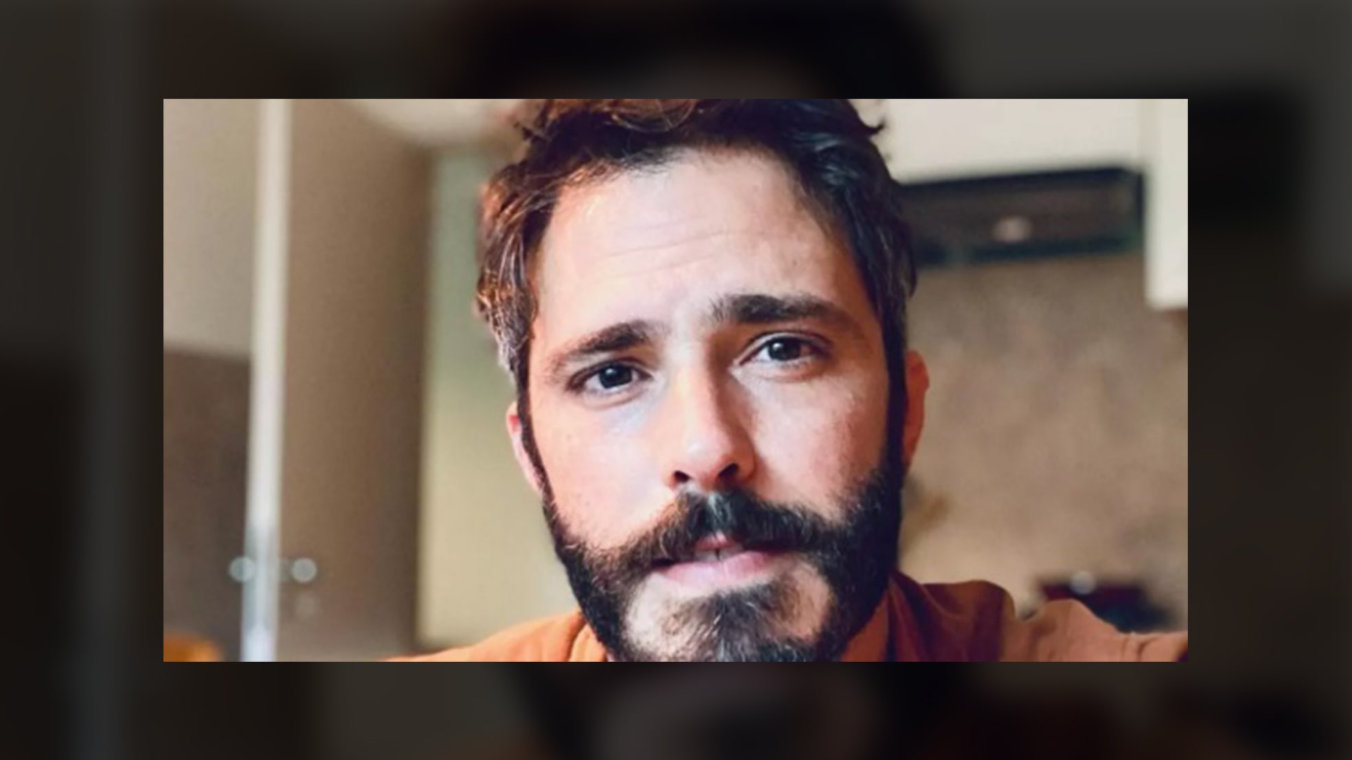 Ator Thiago Rodrigues é espancado durante assalto e tem couro cabeludo arrancado