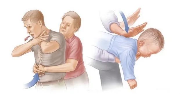 Mais de 94% dos casos de asfixia por engasgo ocorrem em crianças