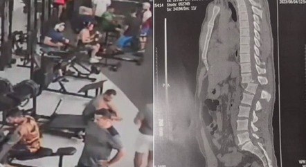 Campanha para homem atingido por aparelho em academia supera meta e arrecada mais de R$ 100 mil