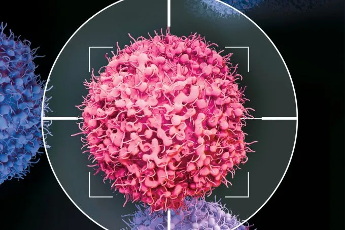 Sinais no corpo que indicam algum tipo de câncer