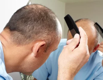 Novo remédio contra queda de cabelo é aprovado pela Anvisa: baricitinibe é usado contra artrite, dermatite e Covid