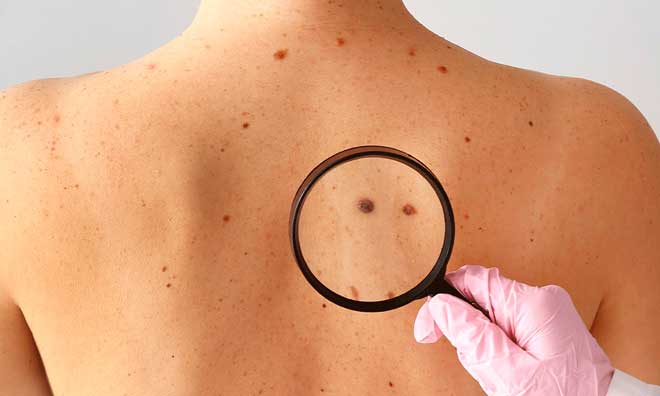 Mutirão fará sábado o rastreamento